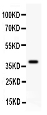 WB - Anti-GAD67 Picoband Antibody ABO11875